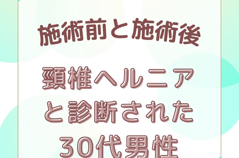 頸椎ヘルニア